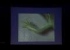 Stephen Badylak: Regenerative Medicine