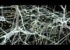 Henry Markram: Supercomputing the brain's secrets