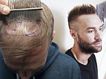 CALUM BEST