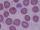 Mouse study shows gene therapy may be possible cure for Hurler syndrome